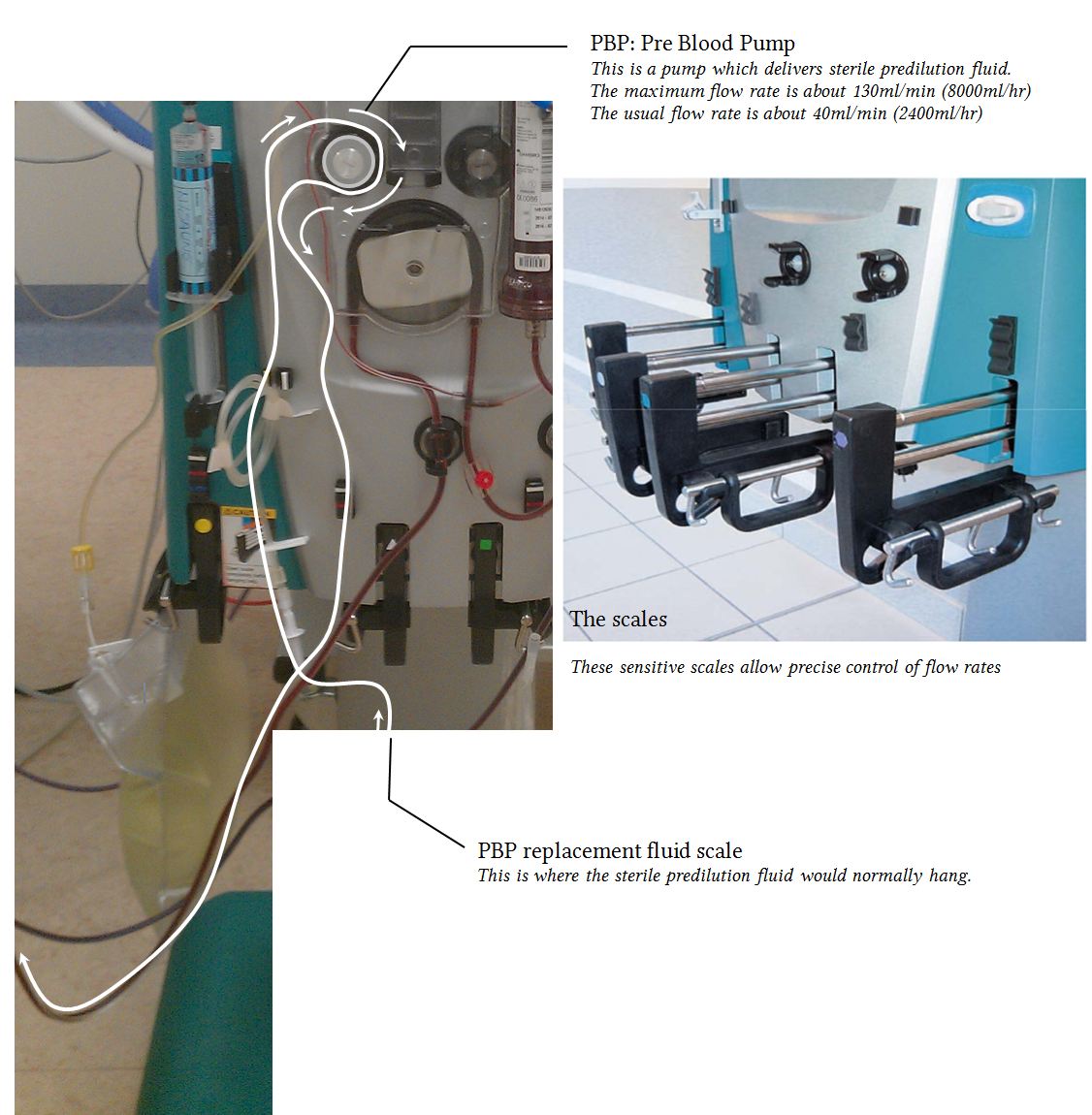Anatomy of the extracorporeal dialysis circuit Deranged Physiology